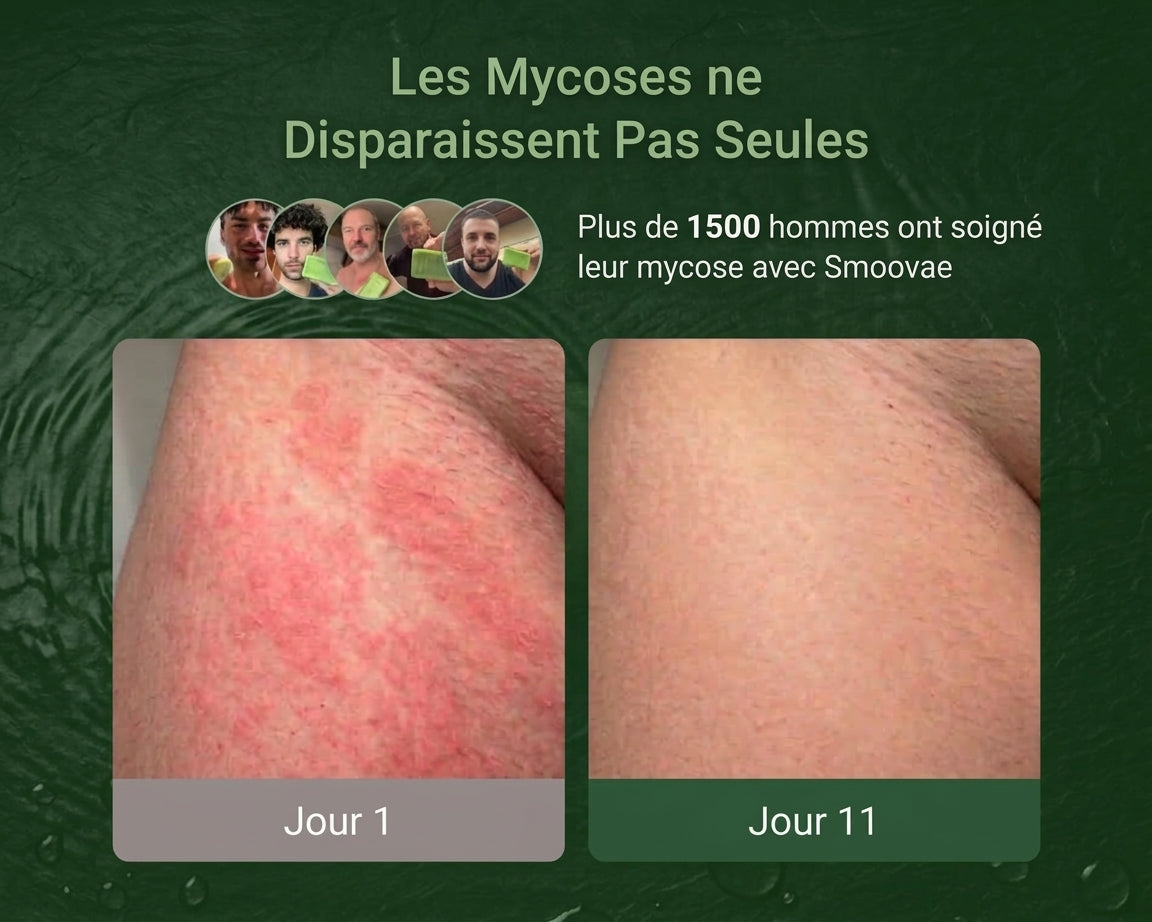 Savon Anti-Démangeaisons Smoovae